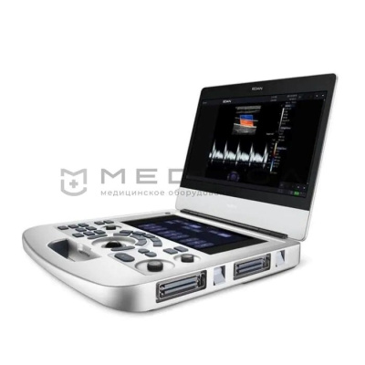 Ультразвуковые аппараты: необходимое для диагностики оборудование