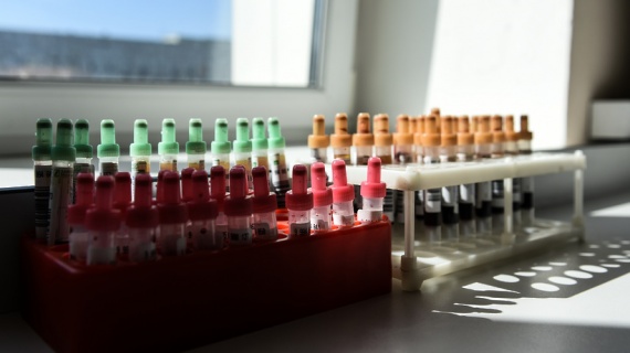 Московская областная станция переливания крови делает тесты на антитела к COVID-19
