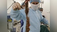 Гигантскую кисту удалили пациентке Коломенского перинатального центра